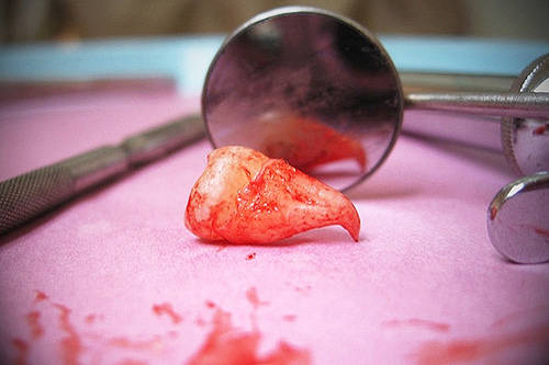 Bloody Tooth