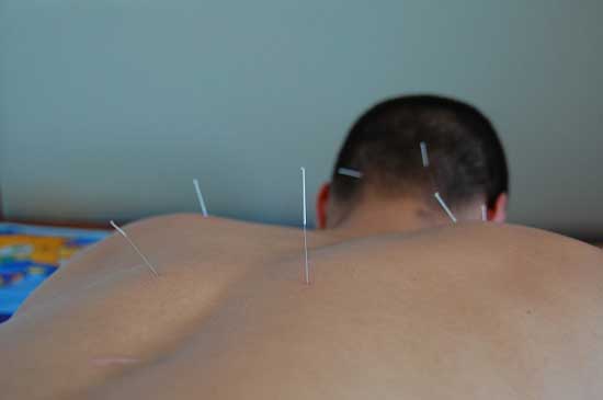 needles in neck
