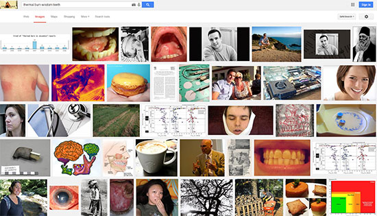 thermal burn wisdom teeth google - The Search Engine Battle: Are you Paying Attention?